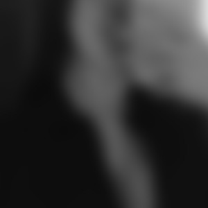 profil-Montpellier-1918